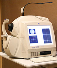 德国蔡司眼底断层扫描仪(OCT)